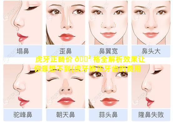 虎牙正畸价 🌲 格全解析效果让你意想不到(虎牙矫正牙齿的费用是多少 🕊 )